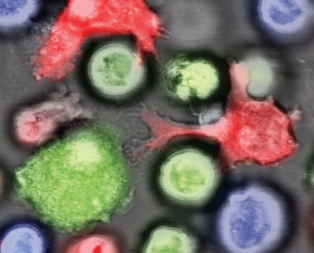 NK cells (red) attack normal leukemia cells (green). Leukemia stem cells (blue), on the other hand, suppress NKG2DL expression at their surface and thus escape destruction by the immune system. © Schürch/Lengerke, University and University Hospital of Basel