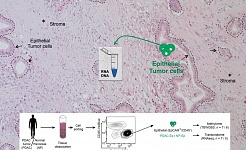 Isolation of epithelial cells form fresh PDAC patient tissues and normal pancreas for analysis of transcriptome and whole genome methylome. (c): Elisa Espinet