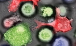 NK cells (red) attack normal leukemia cells (green). Leukemia stem cells (blue), on the other hand, suppress NKG2DL expression at their surface and thus escape destruction by the immune system. © Schürch/Lengerke, University and University Hospital of Basel