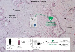 Isolation of epithelial cells form fresh PDAC patient tissues and normal pancreas for analysis of transcriptome and whole genome methylome. (c): Elisa Espinet Isolation of epithelial cells form fresh PDAC patient tissues and normal pancreas for analysis of transcriptome and whole genome methylome. (c): Elisa Espinet