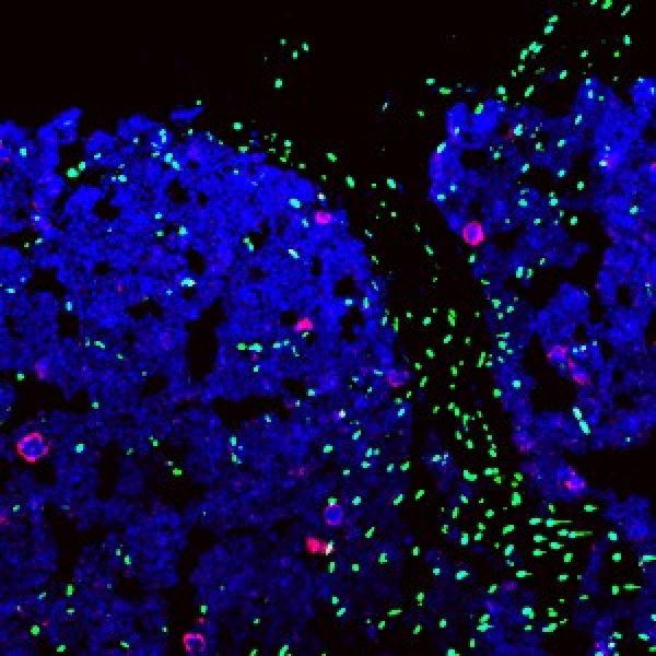 Normal & Malignant  Stem Cells